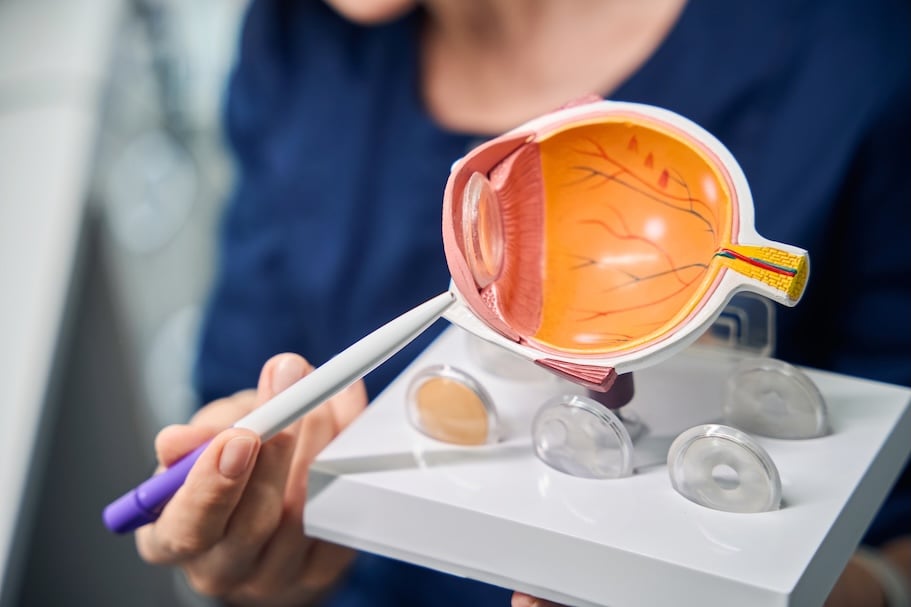 Cirugía de Estrabismo 4