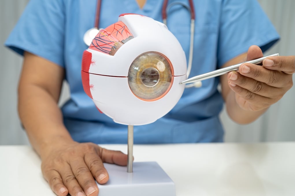 Cirugía de Glaucoma 5