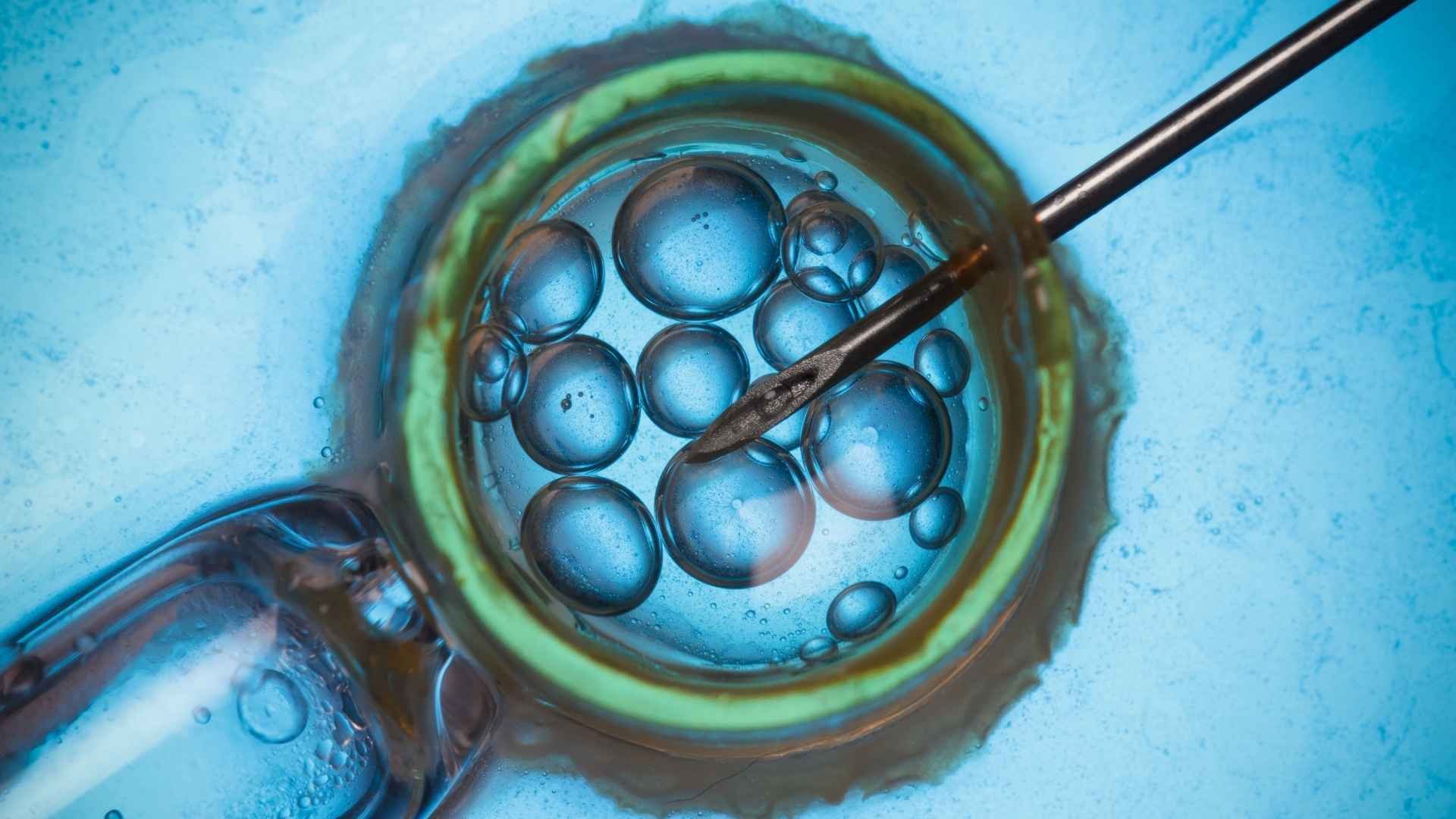 inyección intracitoplasmática de espermatozoides