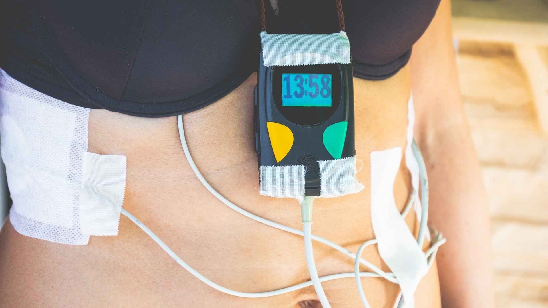 Holter Para Qué Sirve