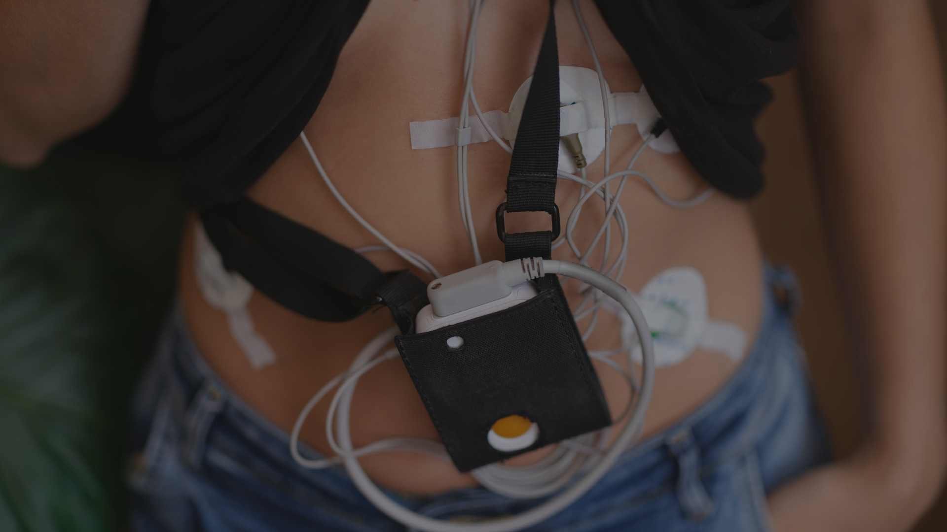 Holter de 24 Horas Qué Debes Saber