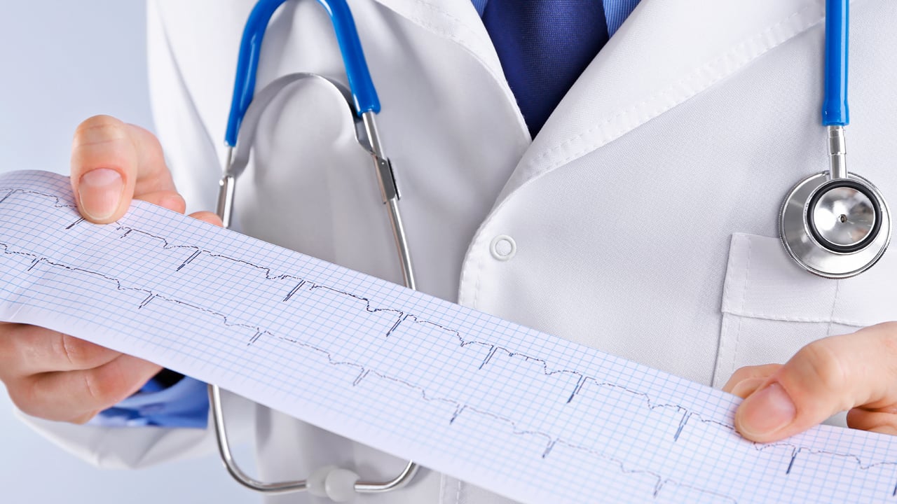 ecocardiograma-examenes-del-corazon-que-necesitas
