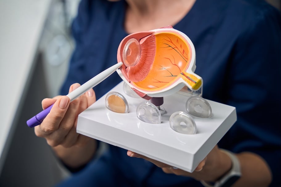 Iridotomía YAG Láser - 2