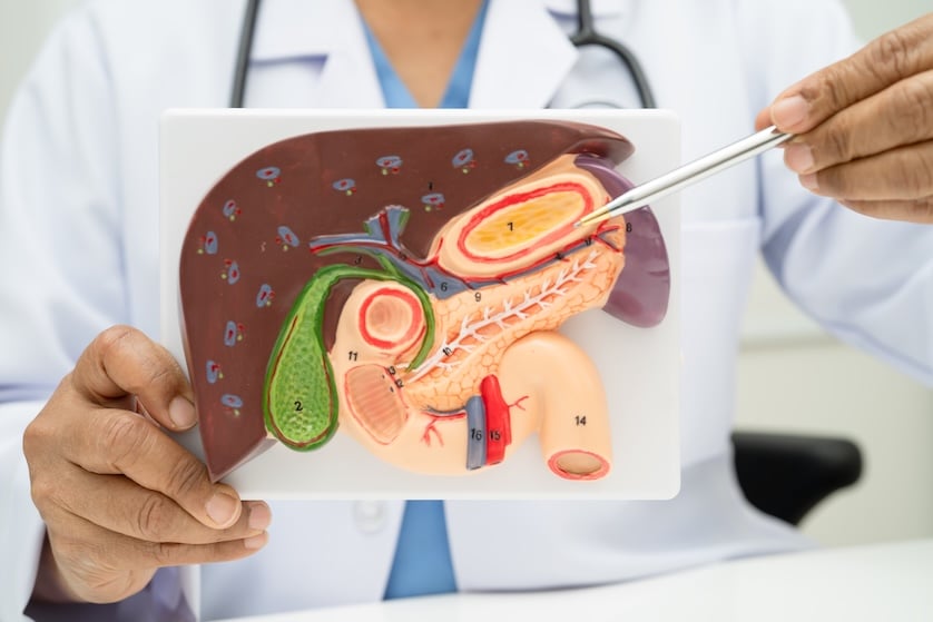 eliminar piedras vesicula 1