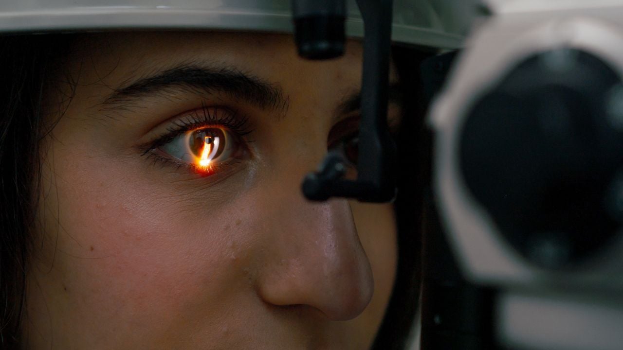 fotocoagulacion con laser como se realiza