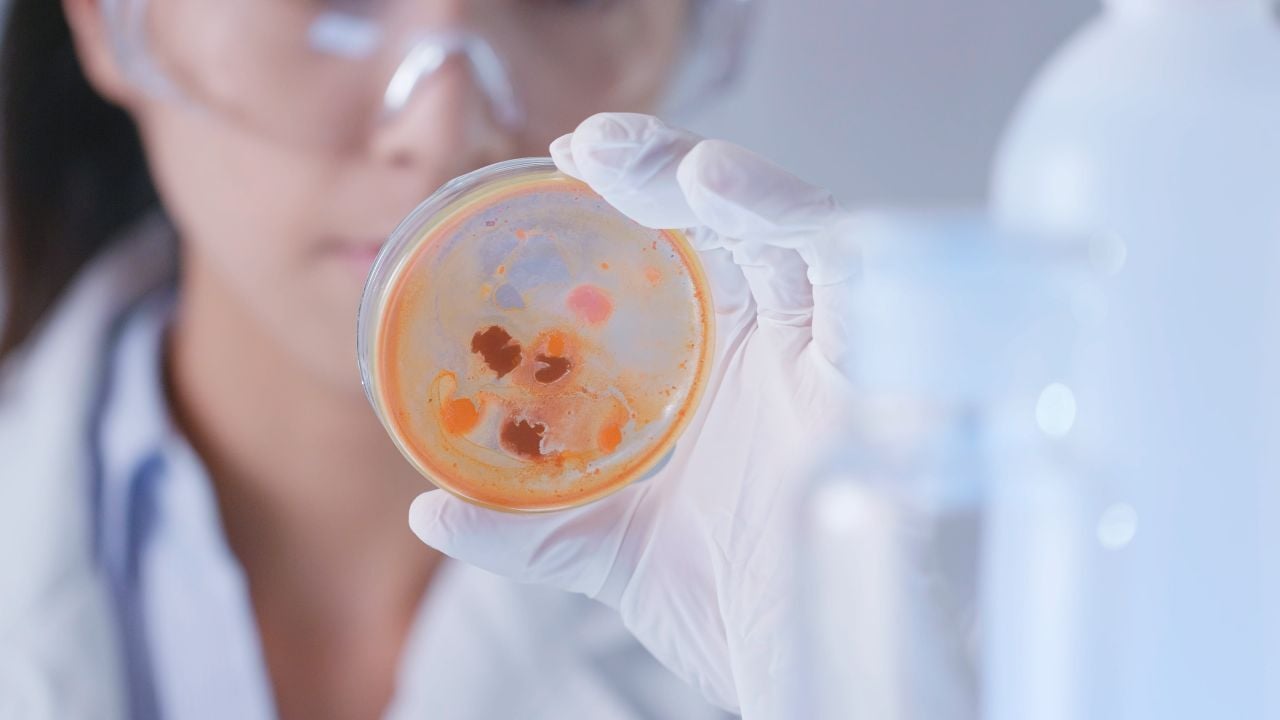 helicobacter-pylori-problemas-digestivos