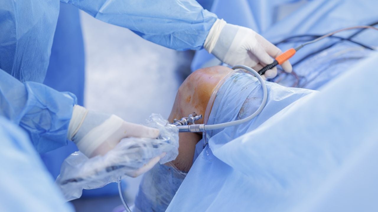 que es artroscopia de rodilla