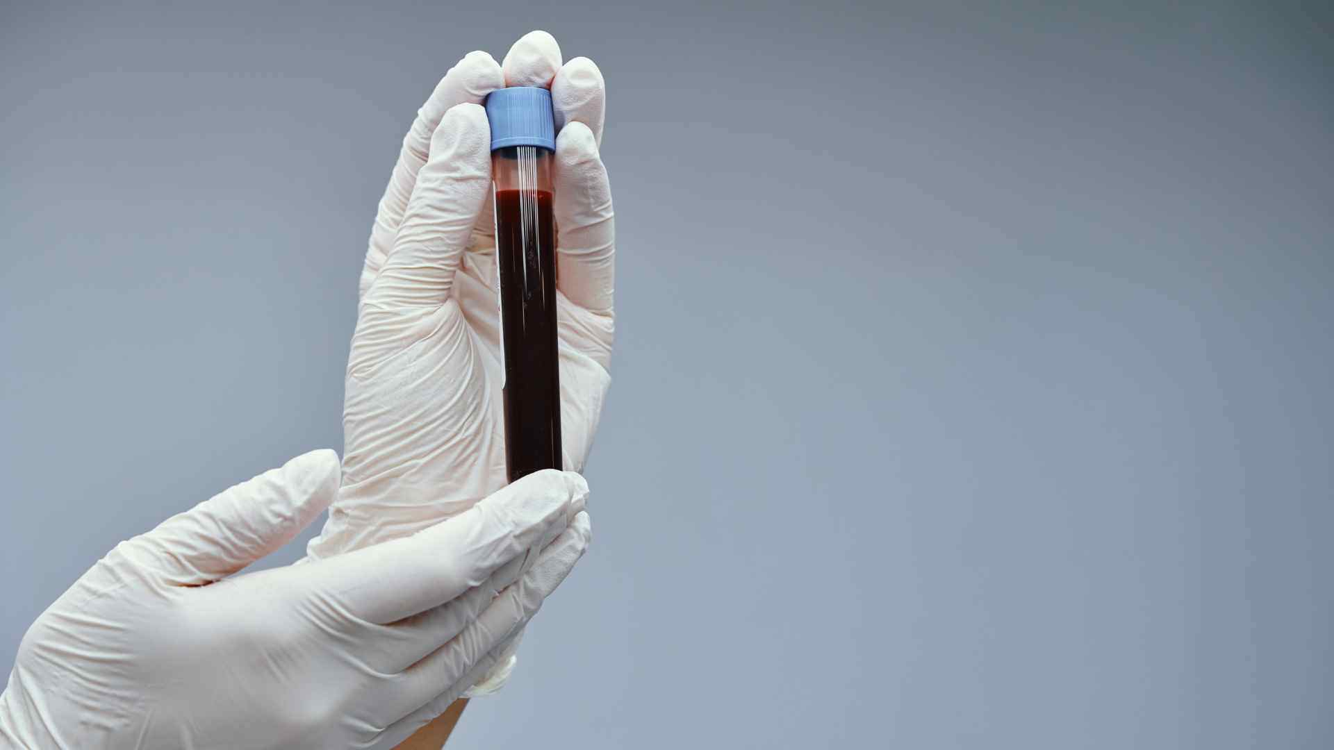 sintomas del cancer a la sangre