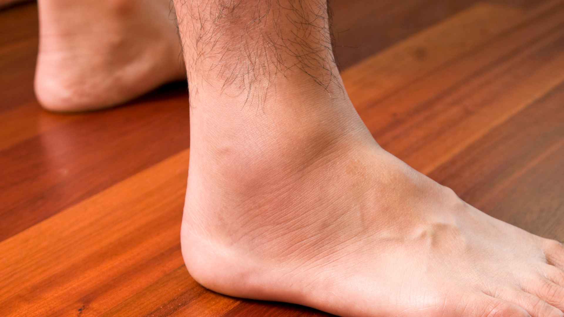 Por Qué se Hinchan los Tobillos: Y Cómo Desinflamarlos