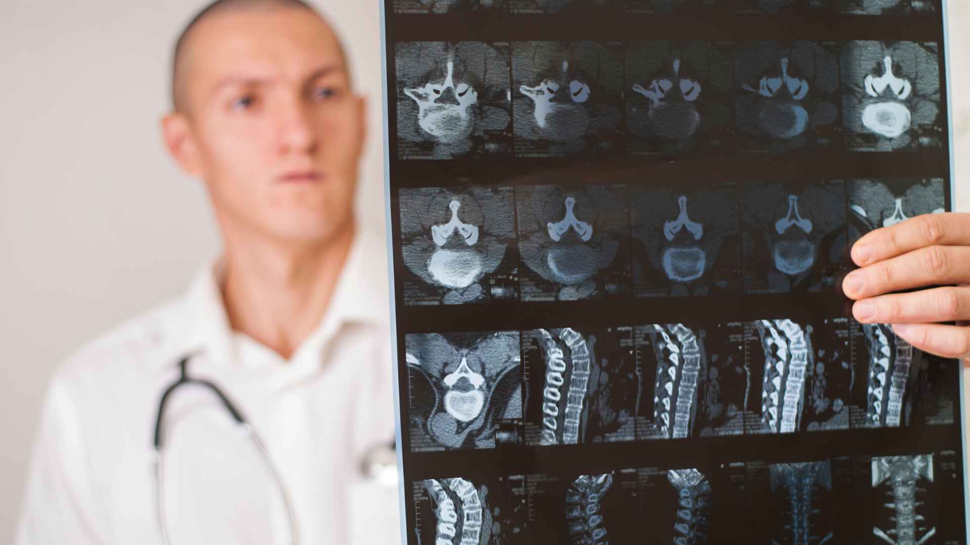 Tomografía: Qué Debes Hacer al Hacerte Una