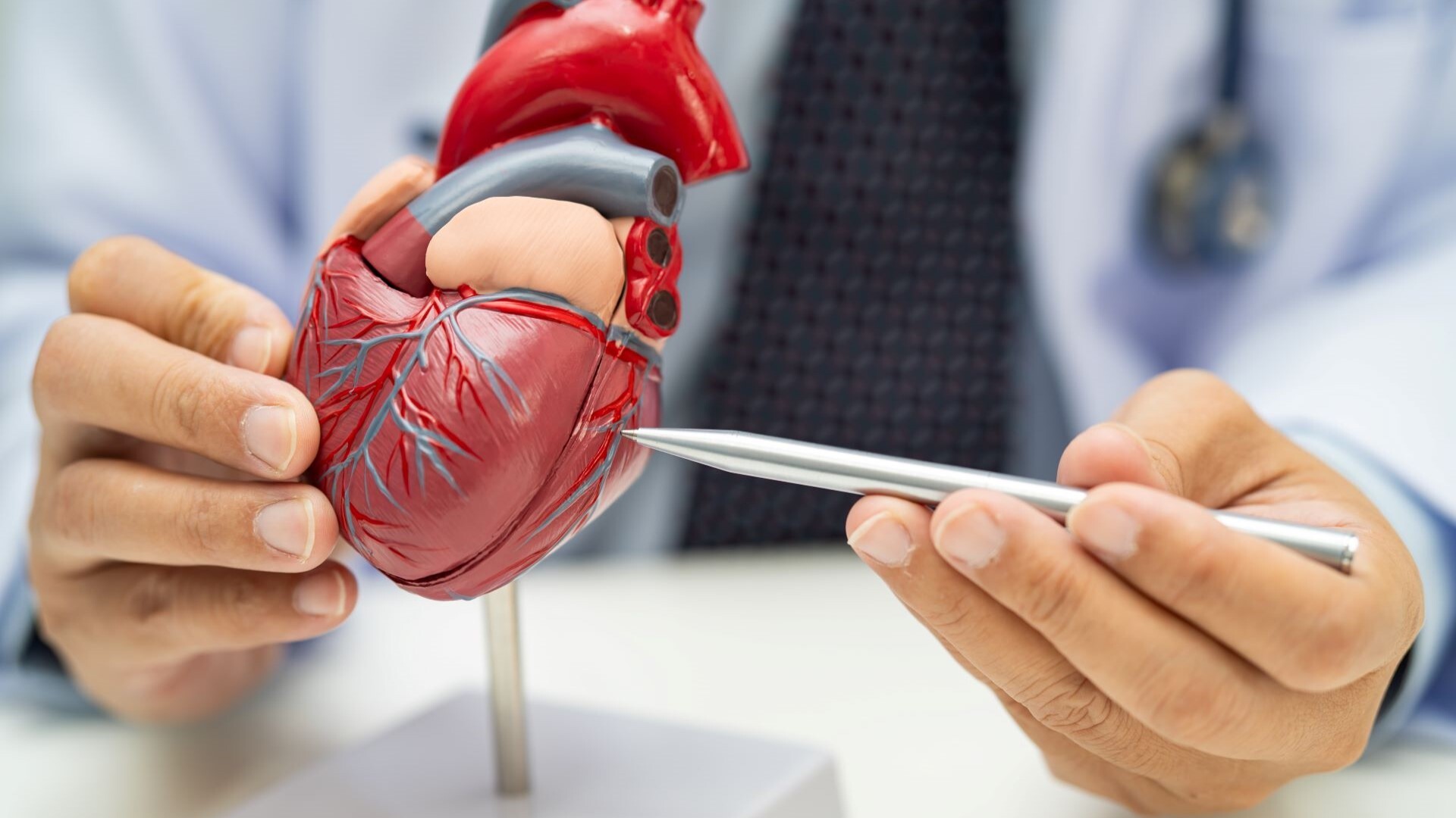 Cómo se realiza una arteriografía: pasos y recomendaciones esenciales